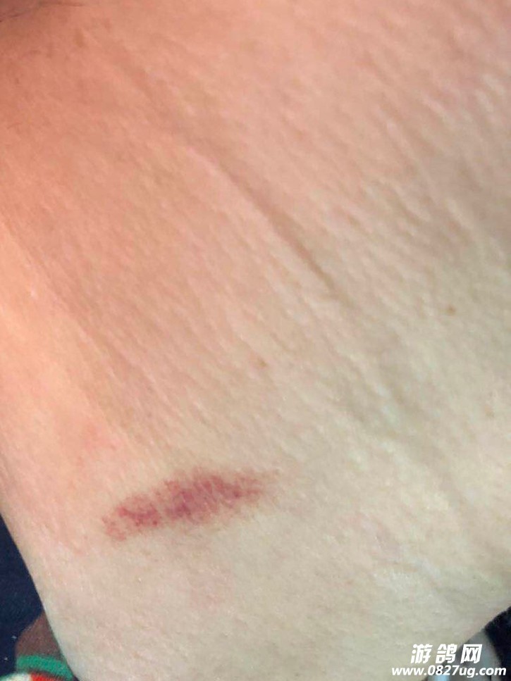 老公出差三天两夜回来,发现脖子吻痕,他说是男人掐的,当我脑残吗?