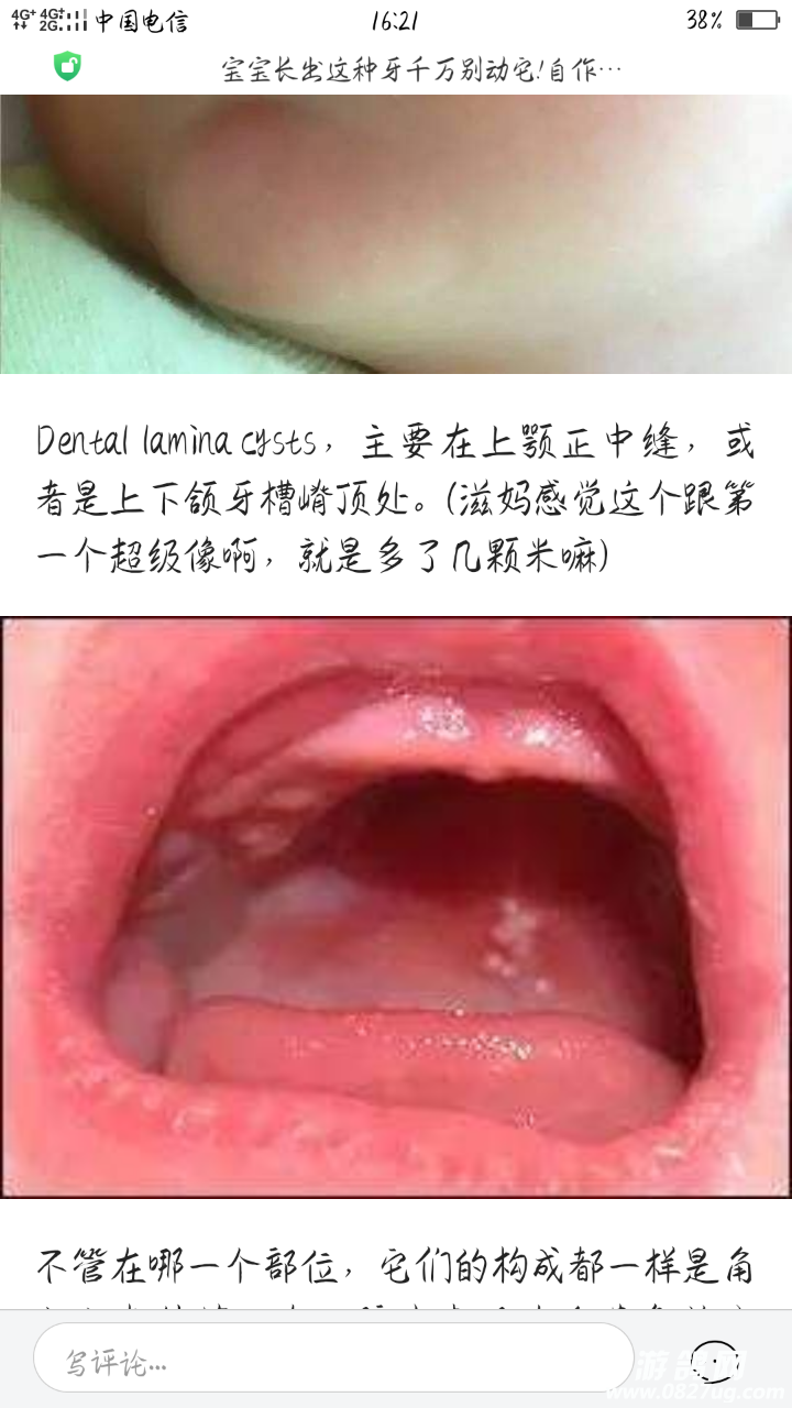 幼儿嘴里长小疮!有的说是马牙有的说是鹅口疮!怎么