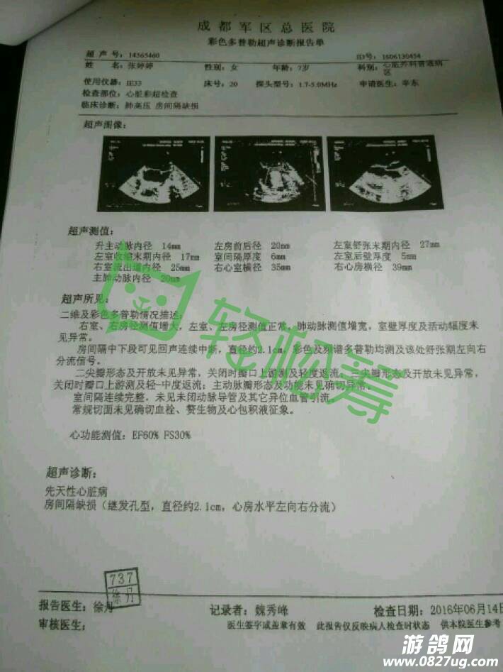 175039cxxxt1h11rtq1wwm.jpg